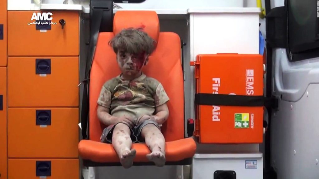 Anak berlumur debu duduk di dalam ambulans.